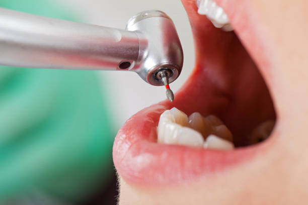 Best Emergency Broken Tooth Repair in Gardende, AL
